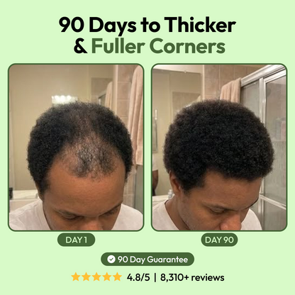 Get Your Hair Back